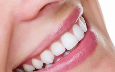 Why You Get Better Results with Dental Teeth Whitening