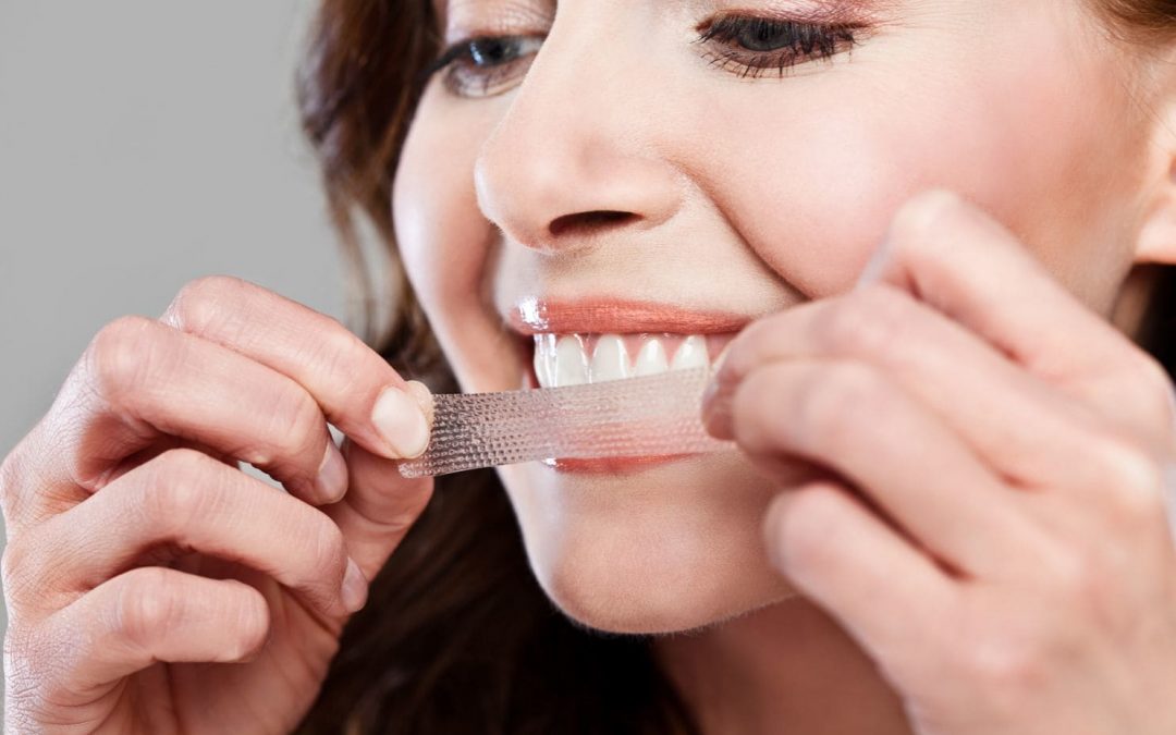 7 Important Facts about At-Home Teeth Whitening
