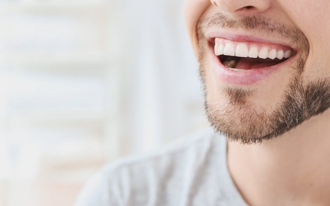 5 Reasons Why Teeth Whitening Matters