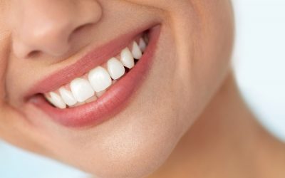 5 Reasons Why You Should Whiten Your Teeth