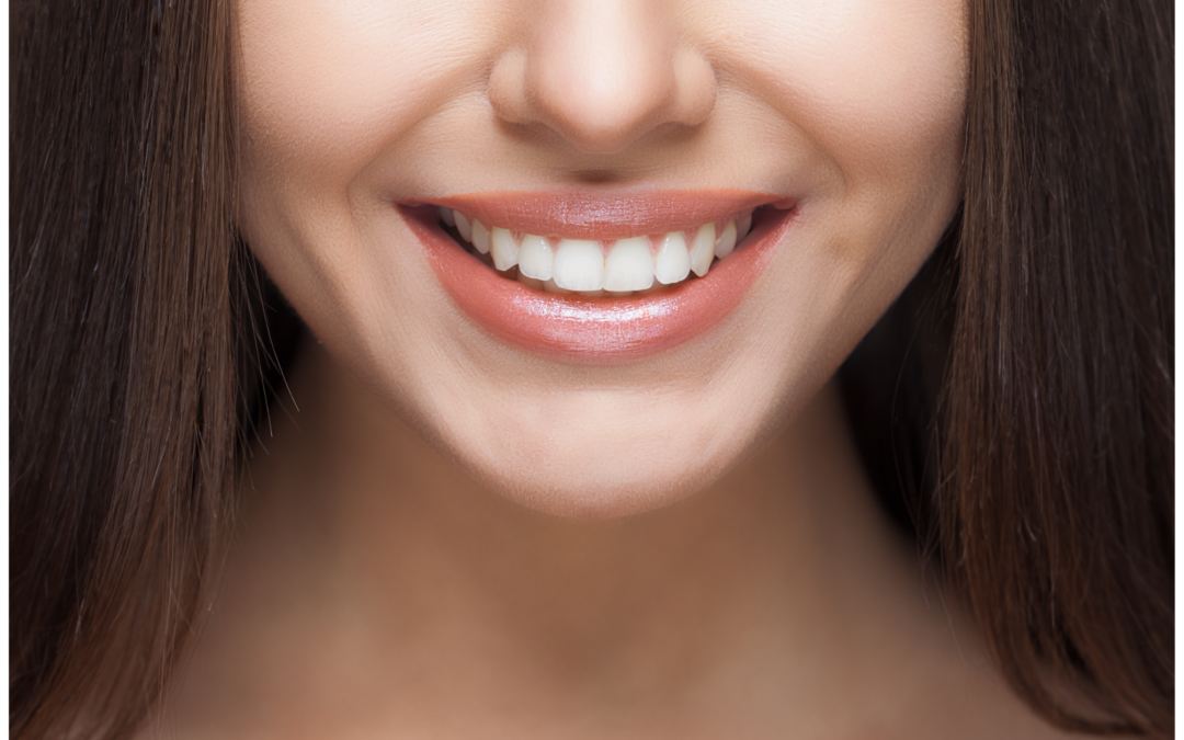 Is it Worth it to Get Your Teeth Professionally Whitened?